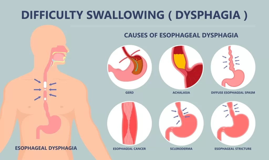 dysphagia-2.jpg