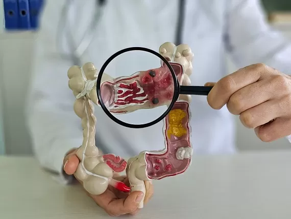 Боль при дефекации