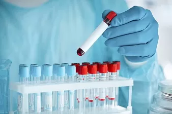 Диабет и потенция у мужчин – как они связаны