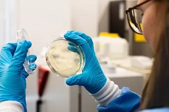 Что такое сальмонеллез?