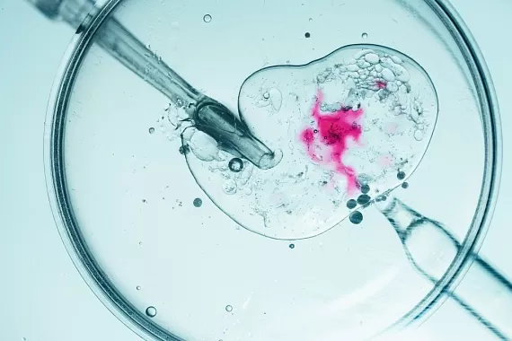 Все самое важное об ЭКО