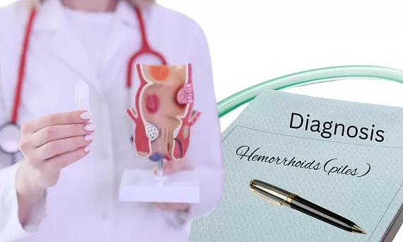 Проктит и анальные трещины