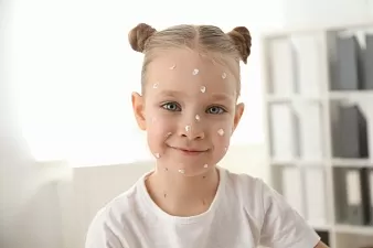 Сыпь у ребенка