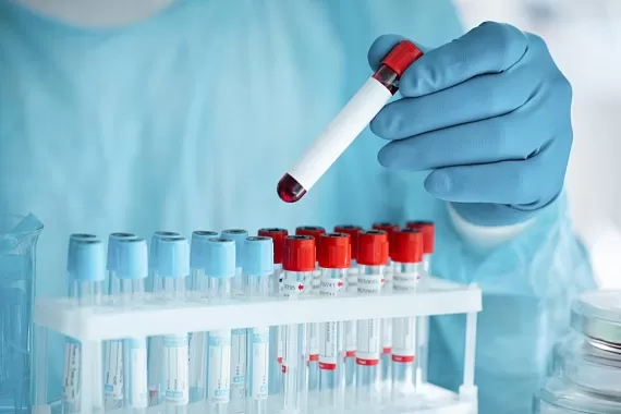 Скрининг или НИПТ?